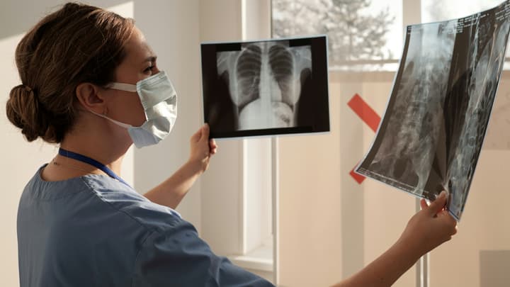 Rentgen (RTG) klatki piersiowej