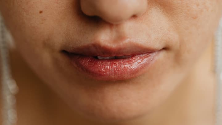 Grzybica jamy ustnej