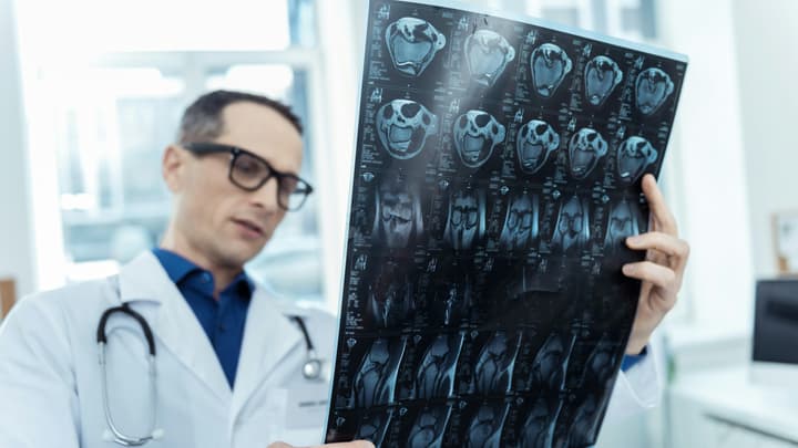 Jak rozpoznać udar mózgu