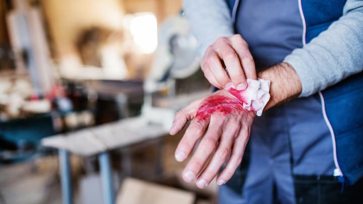 NNW - Czy dostaniesz odszkodowanie?